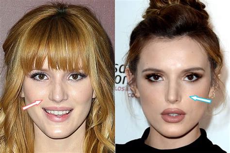 Bella Thorne’s Plastic Surgery – What We Know So Far